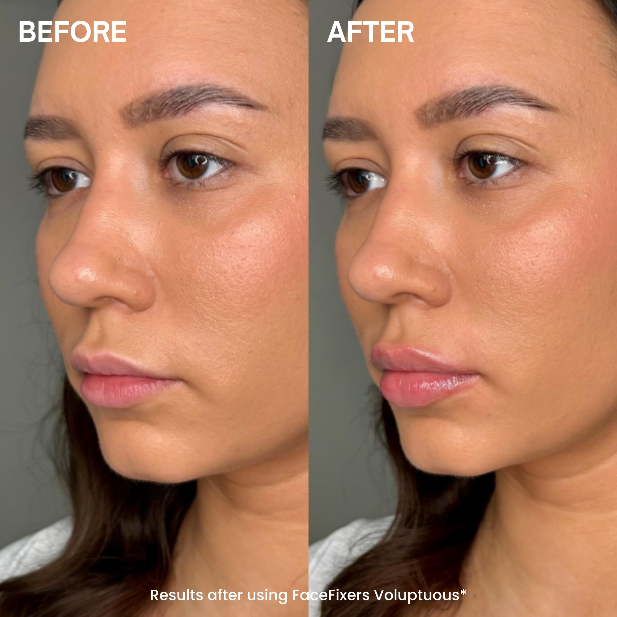 Transformulas Facefixers Duo Instant Lip Plumping Serum Day and Night | Day and Night Lip Enhancer Duo Set. Hydrating Sculpting and Smoothing Clinically Proven Serums for Fuller Plumper Lips.