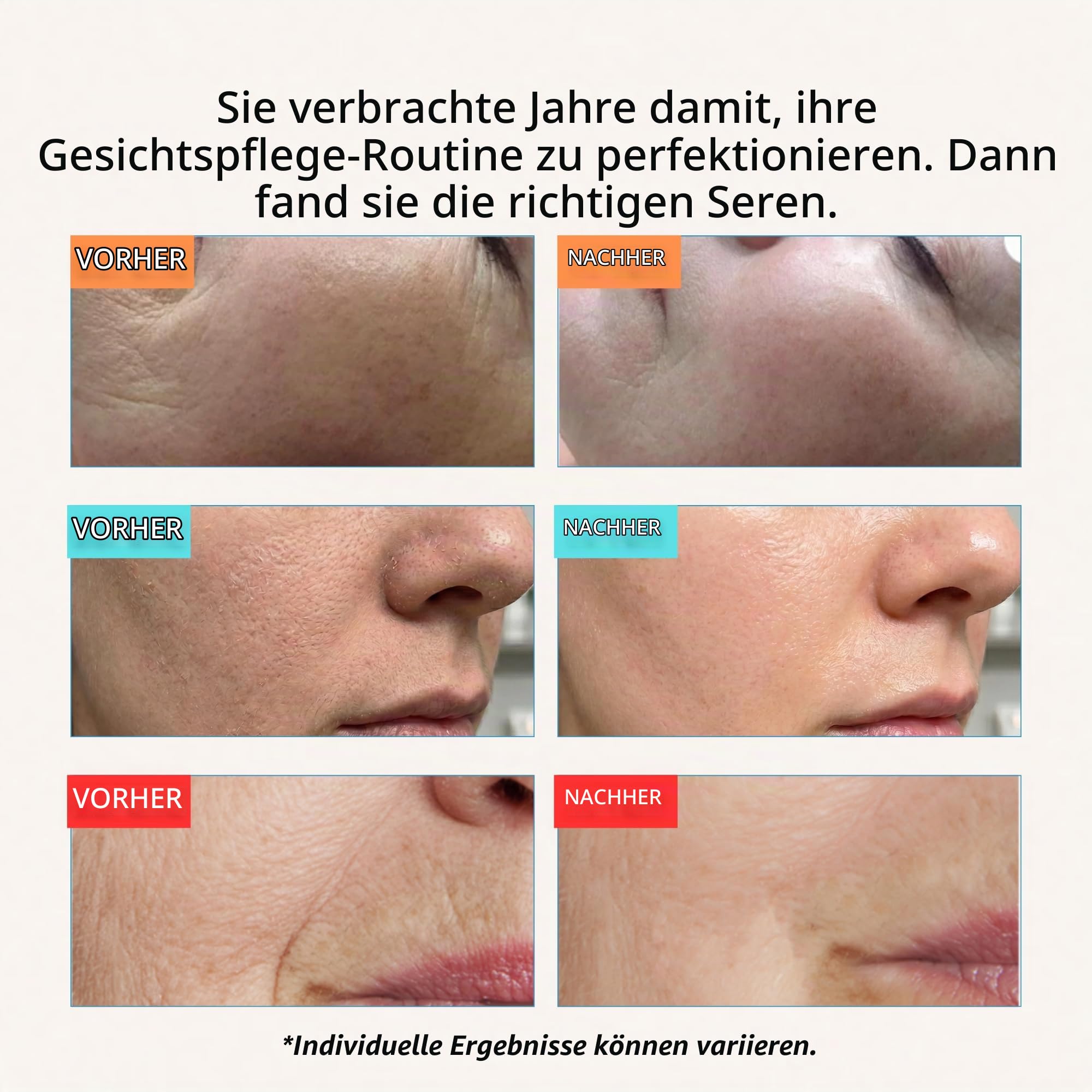 YEOUTH Vitamin C, Retinol & Hyaluron Serum - 3x30ml Gesichtsserum Set - Frauen & Männer Set - Hyaluronic Acid Retinol & Vitamin C für Gesicht
