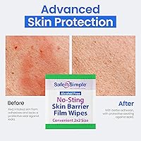 Vista 7 de Safe n' Simple Toallitas preparadoras de piel sin escozor – 100 películas de barrera para ostomía individuales de 2.4" x 2.4" – Toallitas