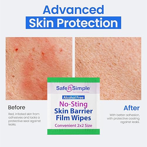 Miniatura 7 de Safe n' Simple - Toallitas de preparación para la piel, sin perfume y sin alcohol, almohadillas suaves de preparación para la piel para adhesivo, 75