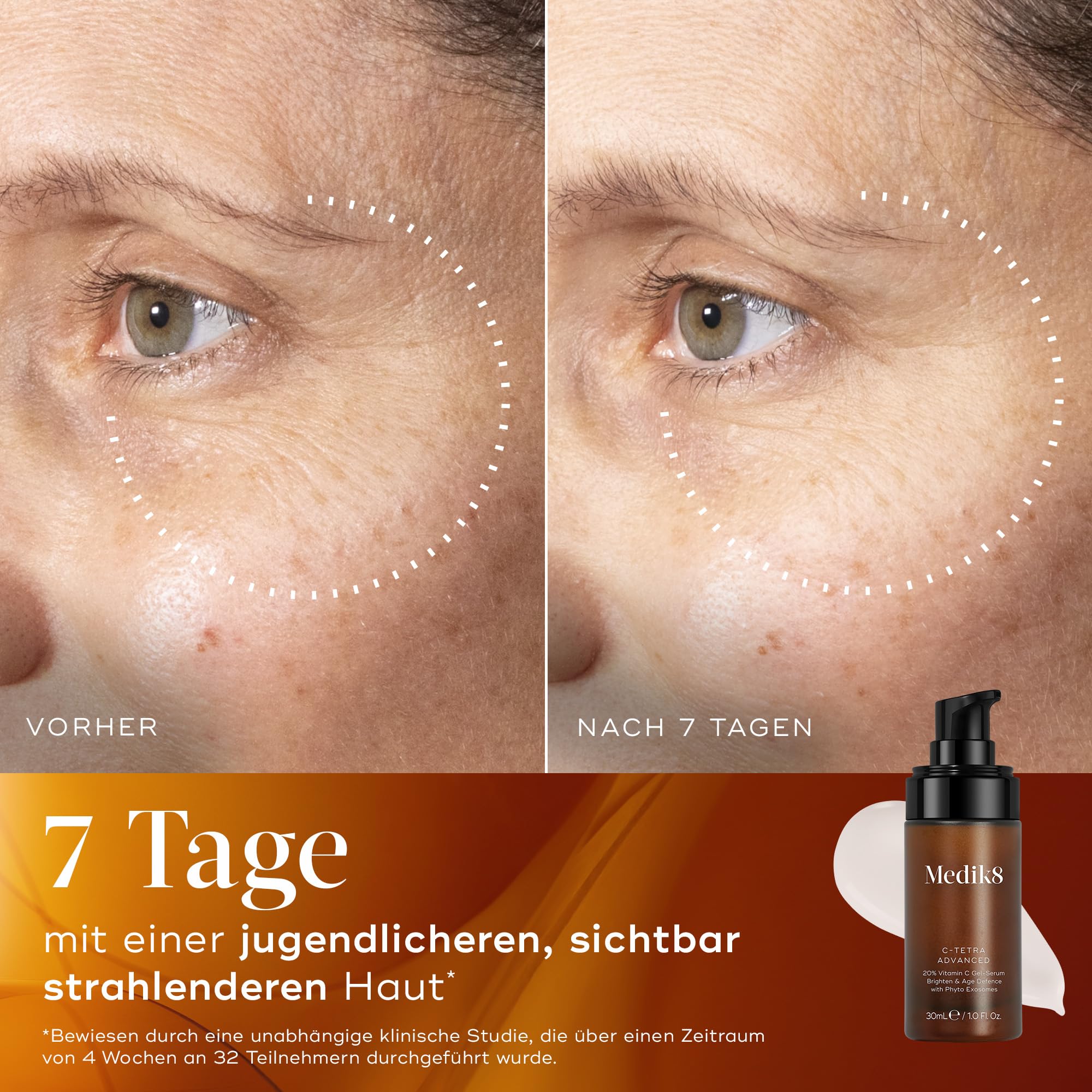 Medik8 C-Tetra Advanced, 20% Vitamin C Gel-Serum mit Exosomen - 30 ml | Vitamin-C-Serum mit Exosomen – schützt vor vorzeitiger Hautalterung und sorgt für eine beschleunigte Aufhellung des Hautbilds