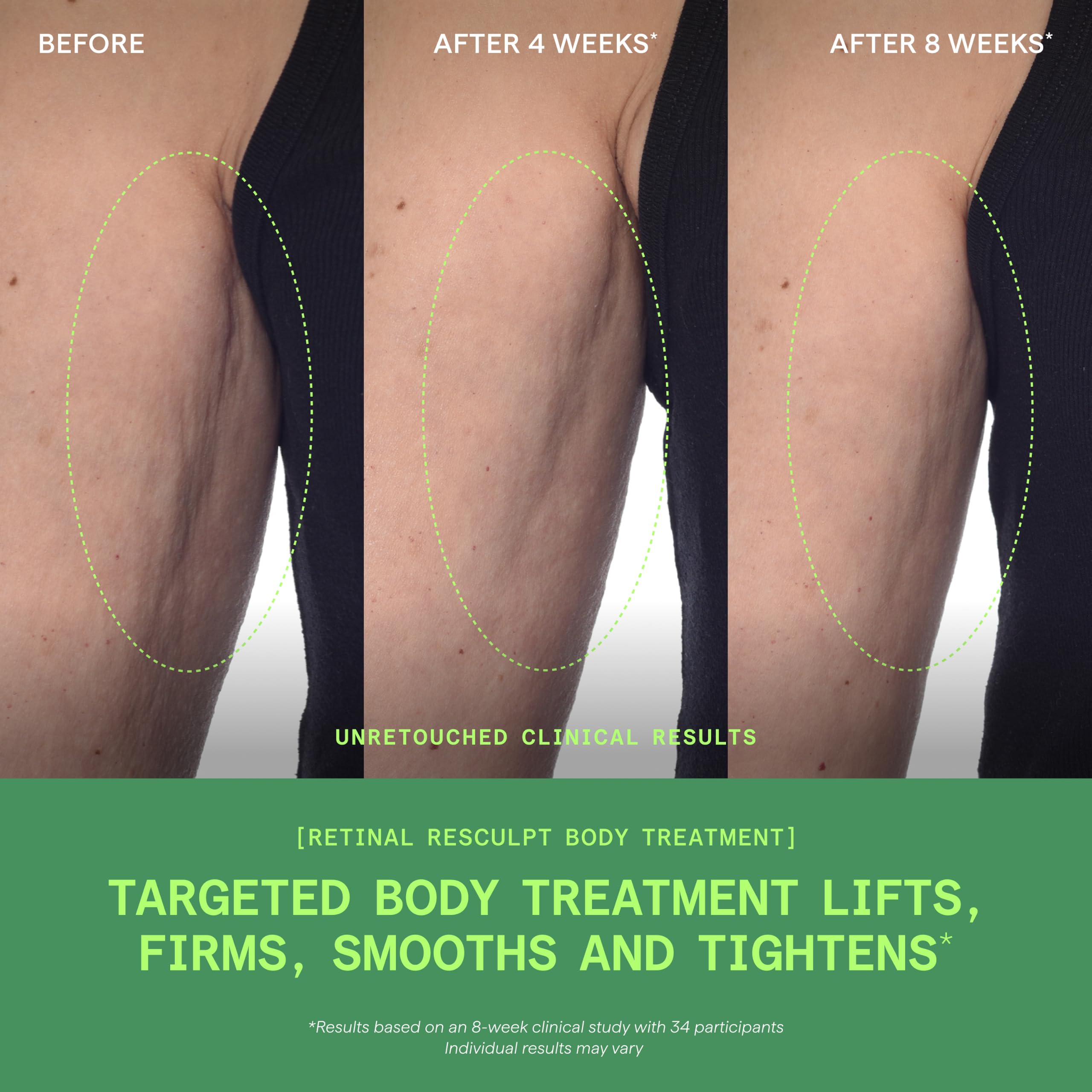 Retinal ReSculpt Traitement corporel – Crème pour le corps rétinienne pour cibler la cellulite et les vergetures – Soulève, raffermit et resserre la peau affaissée, crépule, 150 ml