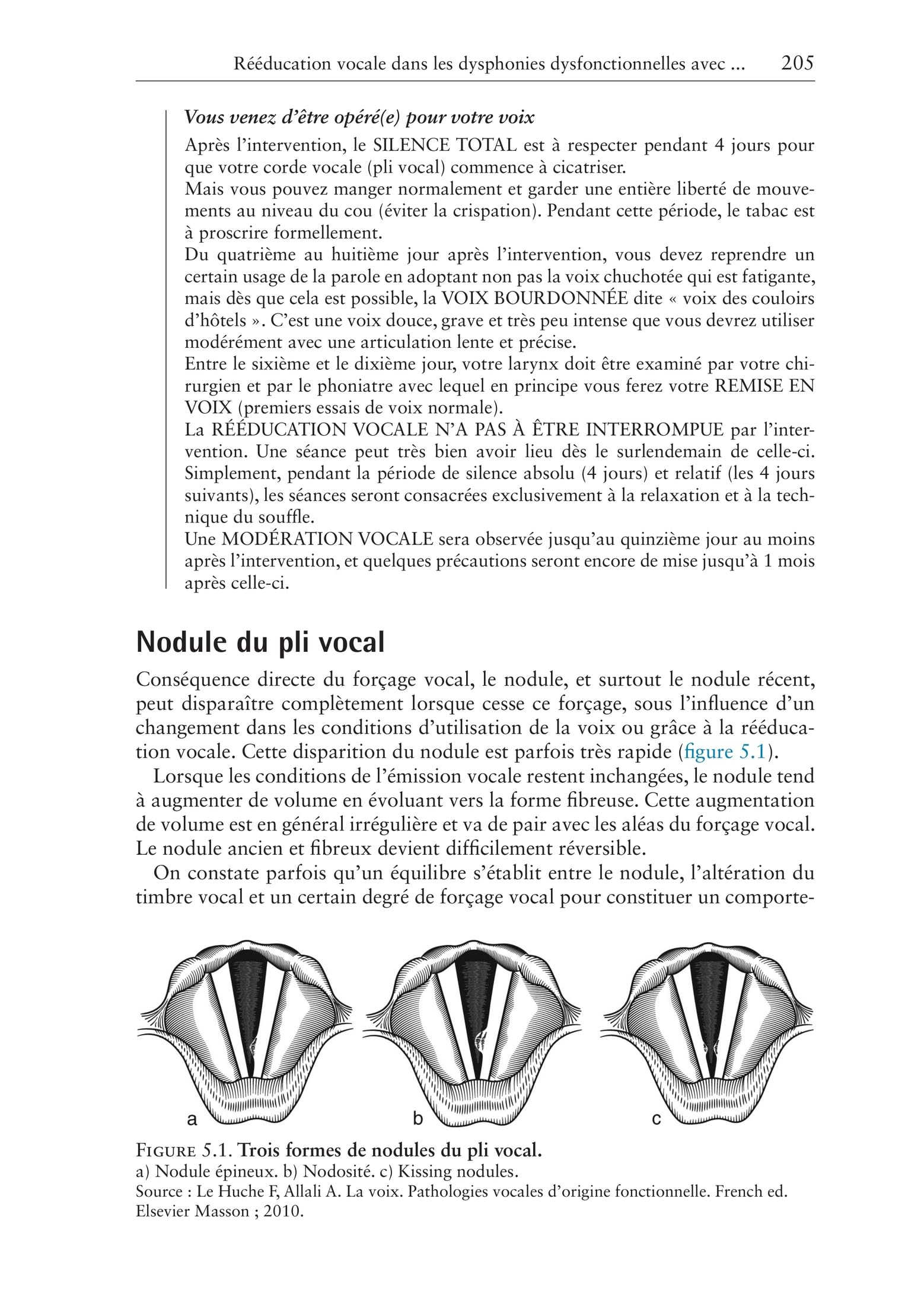 Traitement rééducatif des troubles vocaux