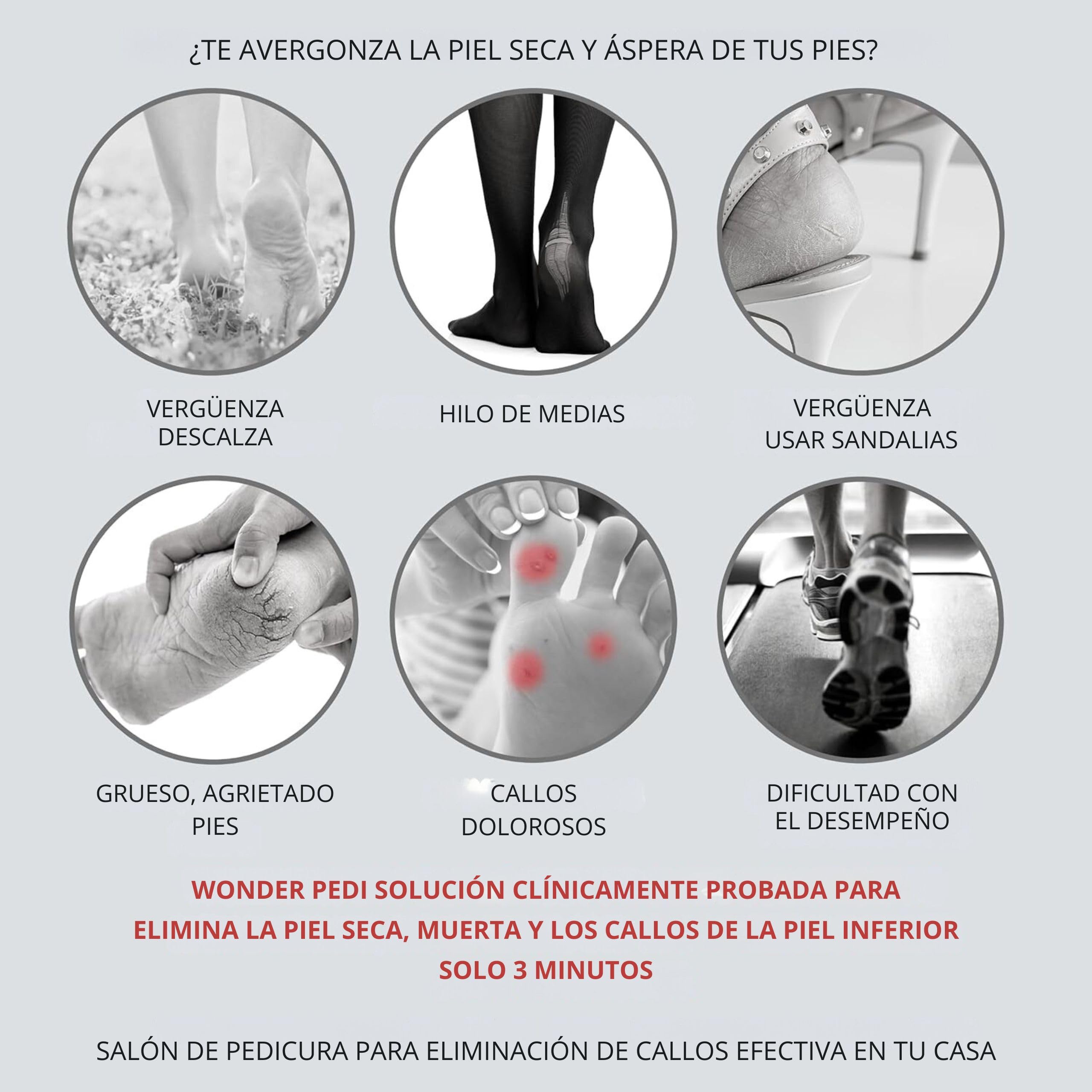 Removedor de callos – Tres minutos de fijación rápida – Escofina de lima de pies – Exfoliante instantáneo de pies Suavizante exfoliante Peel Spray, lima para talones y callos (Suavizante 200 ml)