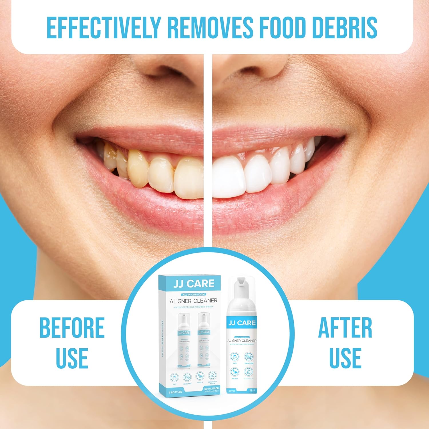 Buy JJ CARE Aligner Cleaner [Pack of 2] 80ml, Invisalign Cleaner, Lemon