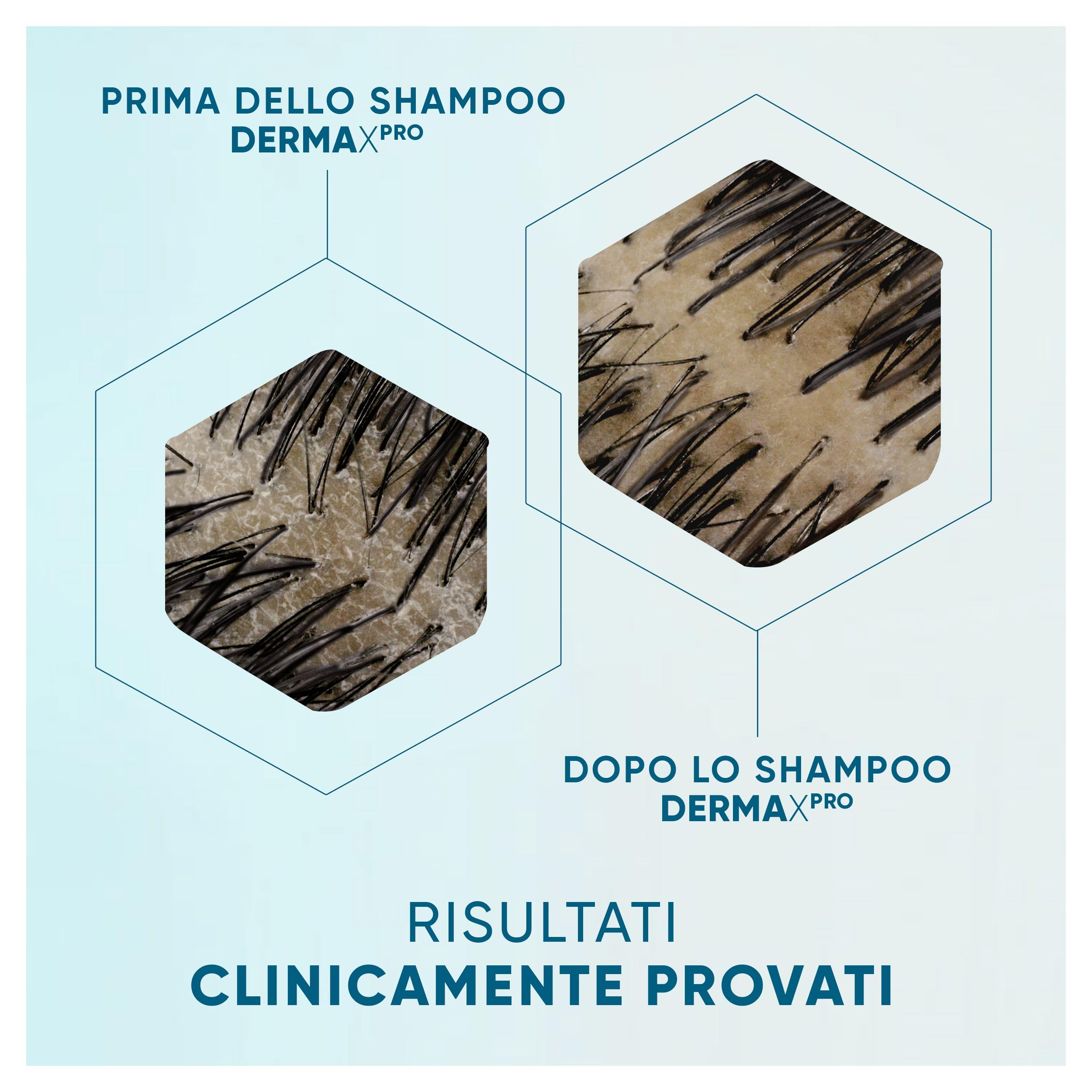 Shampoo Antiforfora Head & Shoulders DermaXPro Lenitivo 800ml Con Estratto Di Aloe Vera E Complesso Di Ceramidi, Lenisce La Cute Secca E Pruriginosa E Aiuta A Rafforzare La Barriera Cutanea