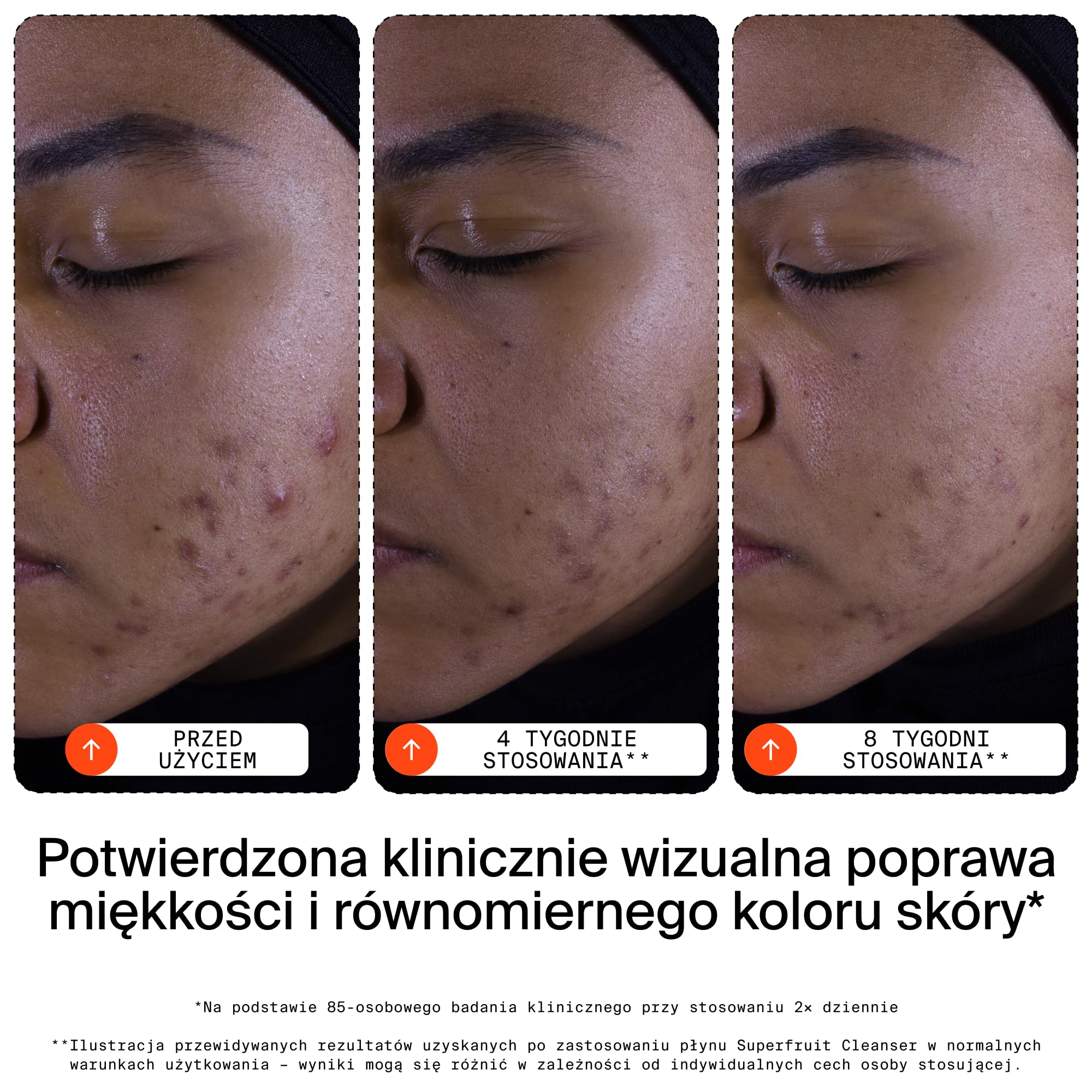 Youth To The People Superfruit Cleanser, Żel do Mycia Twarzy dla Kobiet, Delikatny Peeling z Papają & Wit. C, Rozświetlający Płyn do Mycia Twarzy, Nawilżający Żel do Mycia Twarzy