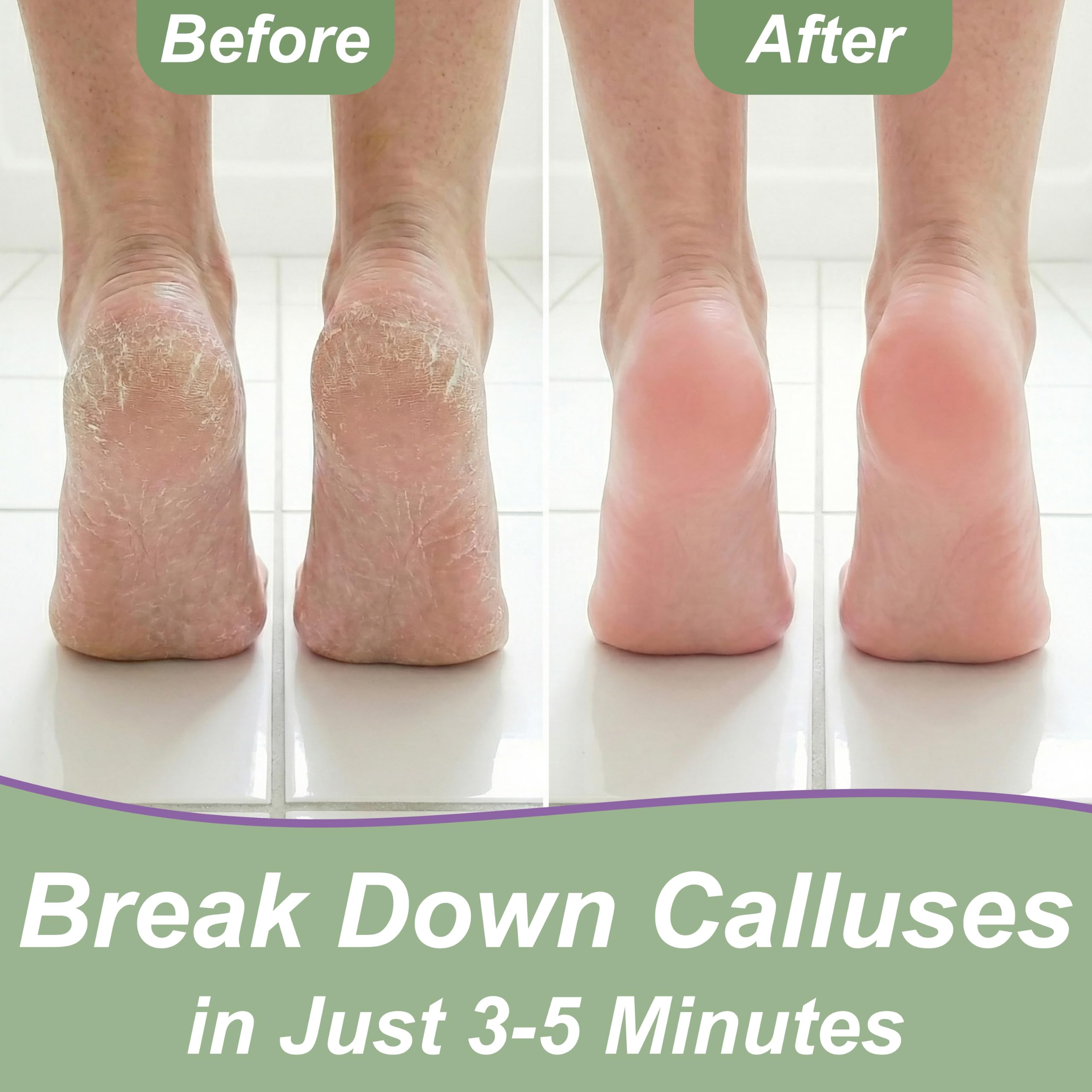 Callus Remover for Smooth Feet -4 Callus Remover for Smooth Feet -4