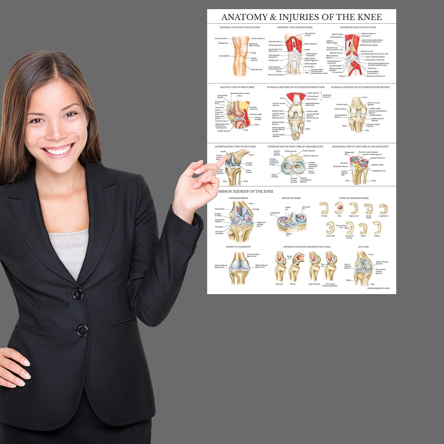 Palace Learning Laminated Anatomy and Injuries of the Knee Poster - Knee Joint Anatomical Chart - 18" x 24"