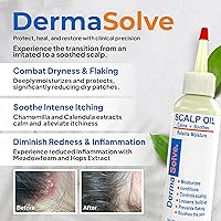 Vista 2 de Dermasolve Psoriasis & Dandruff Oil, Dermatologist Approved for Flaky Scalp Relief