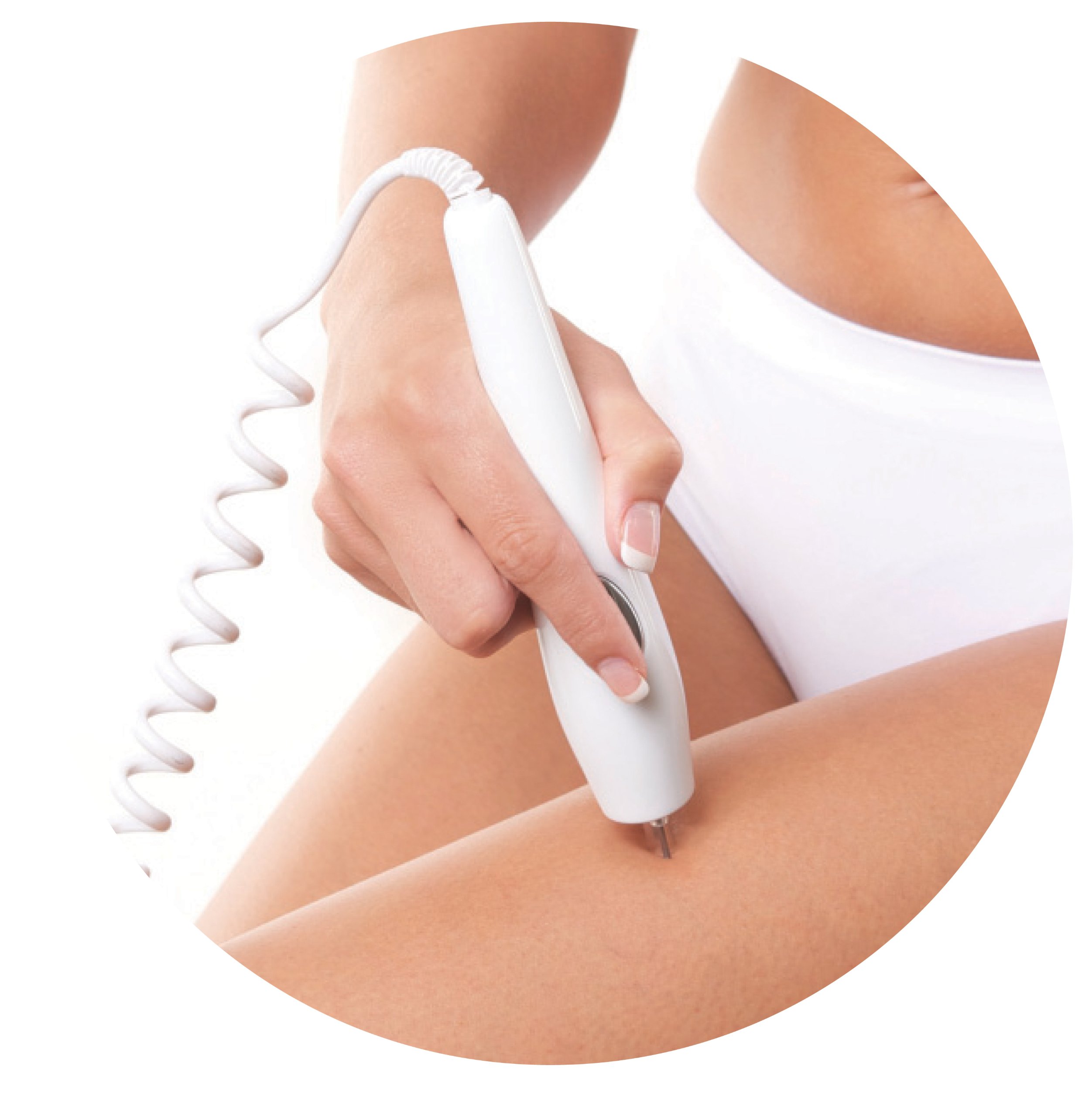 Rio Salon Laser Tweezer - Depiladora láser