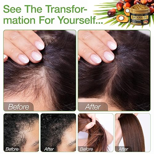 Miniatura 4 de Aceite de batana para el crecimiento del cabello de Honduras, aceite orgánico para el cabello de Batana para eliminar las puntas abiertas, aumenta