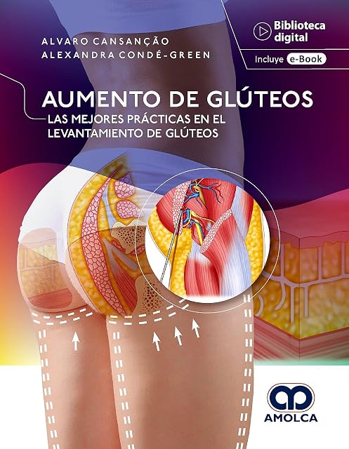 Portada de Aumento de Glúteos. Las Mejores Prácticas en el Levantamiento de Glúte