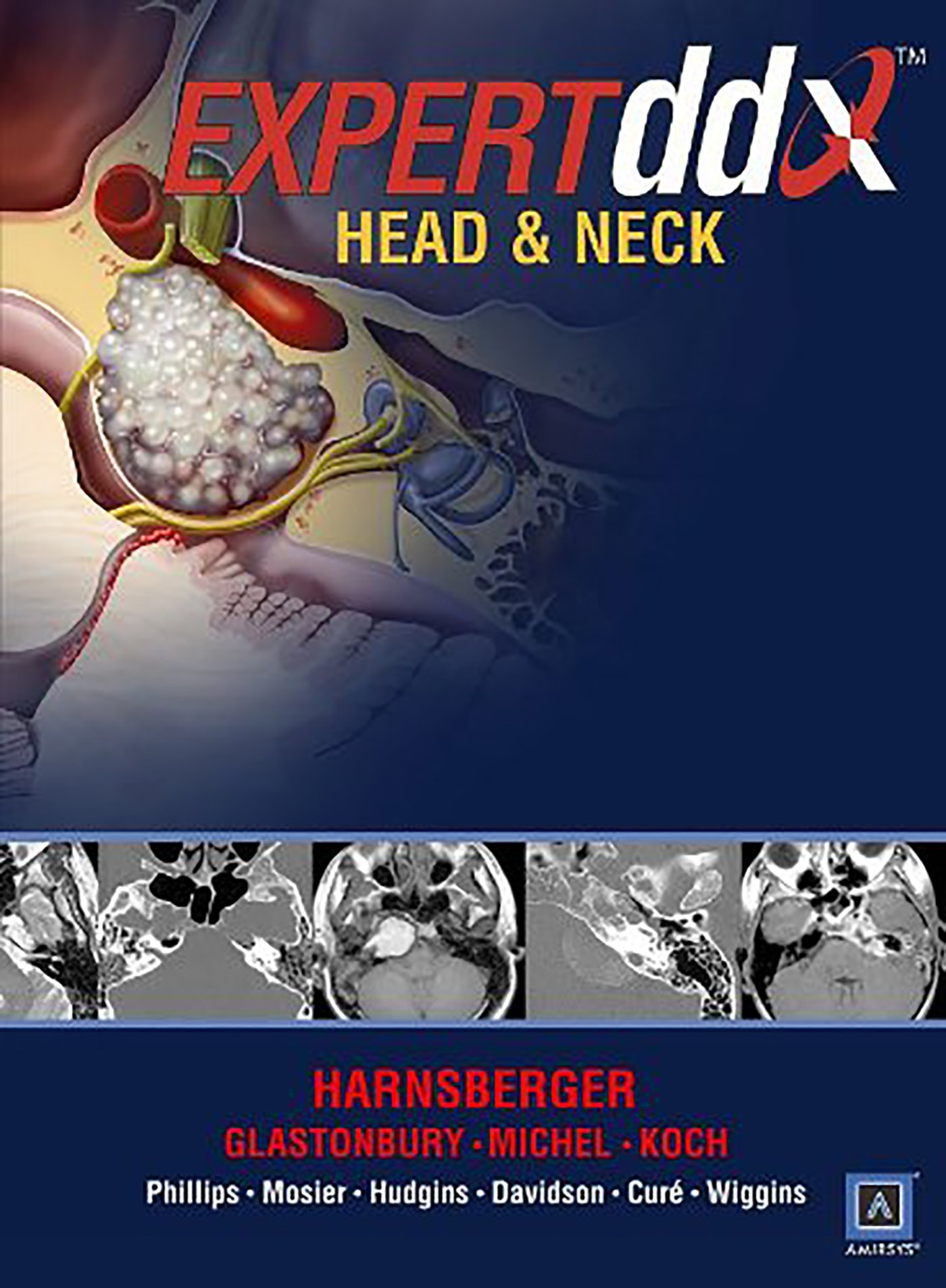 EXPERTddx: Head and Neck: Published by Amirsys (R)