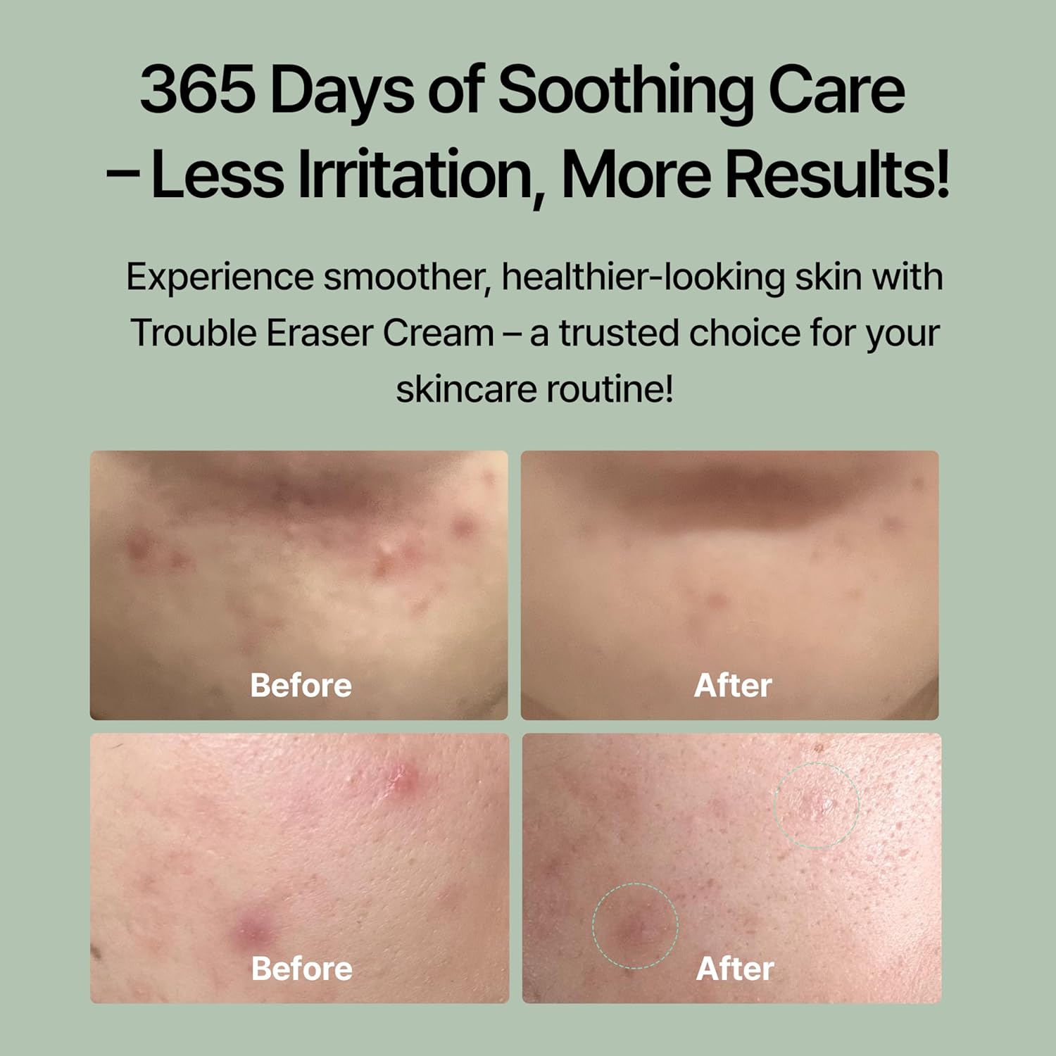 Cica Spot Cream (18ml / 0.60 Fl oz) | Post-Blemish Recovery, Soothing, Redness Relief Gel with Madecassoside, Niacinamide, Panthenol for Sensitive Skin – NDP - Image 4