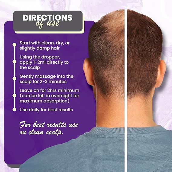 RU58841 5% (50 ML) Hair Rescue - Men's Hair Growth Serum - Hair shedding prevention - 45 day supply