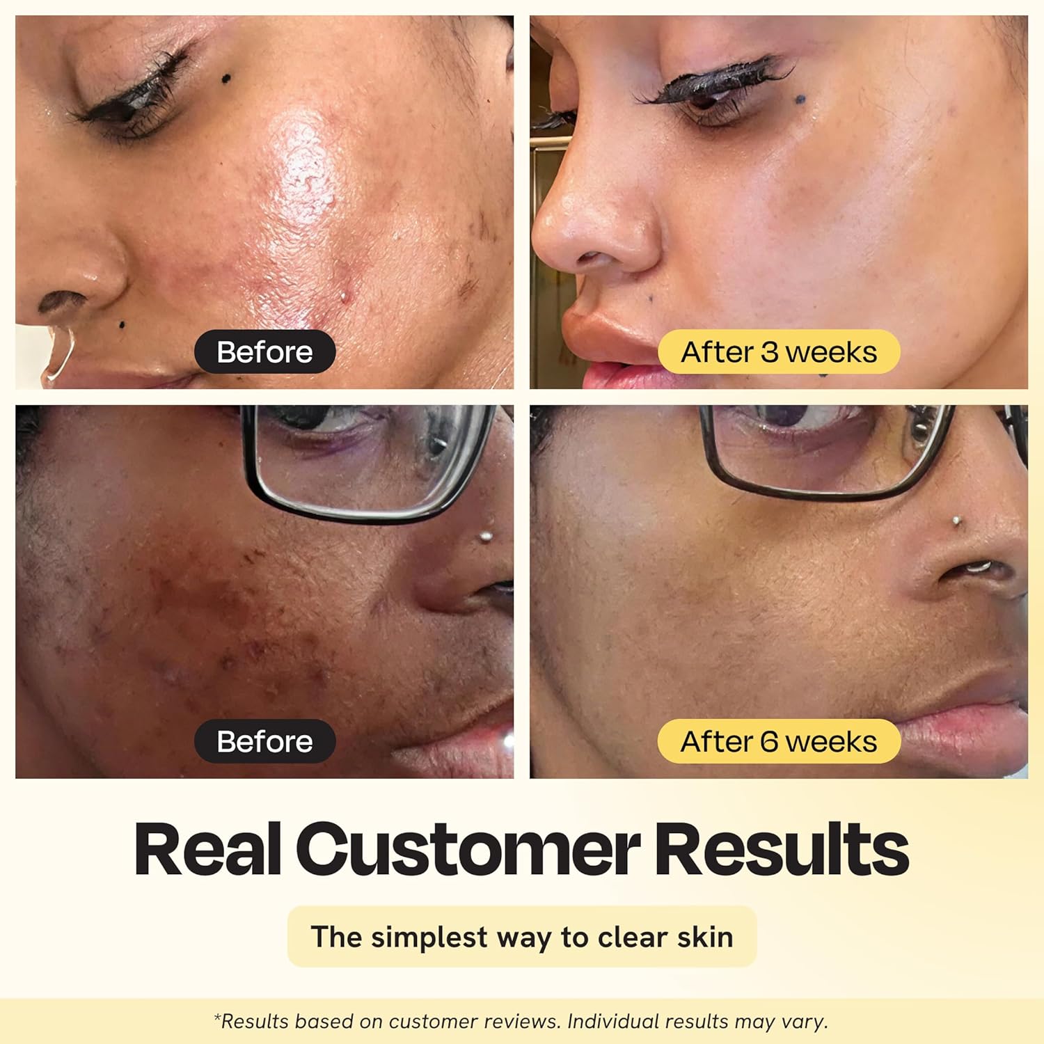 Gleamin Vitamin C Clay Mask for Dark Spots, Turmeric Clay Face Mask Skin Care, Deeply Cleanses & Refines Pores, Brightens Uneven Tone and Helps Improve Post-Blemish Scarring & Texture, Up to 20 Uses - Image 2