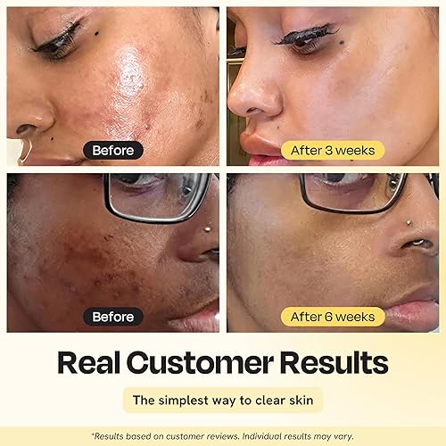 Miniatura 2 de Gleamin Mascarilla y cepillo de arcilla de vitamina C de cúrcuma mascarilla facial de arcilla con aloe tratamiento vegano y cepillo ayuda a mejorar