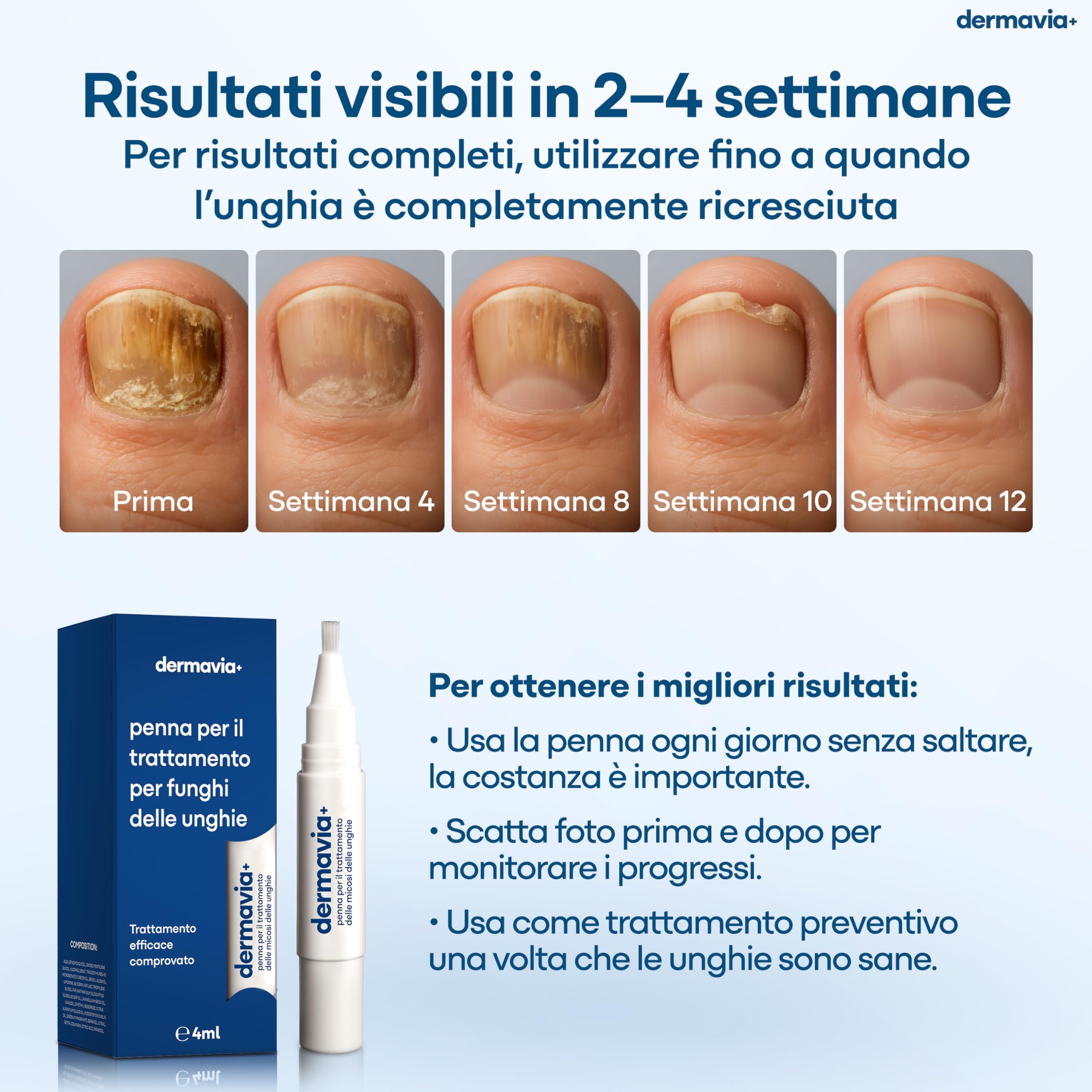 Trattamento per Funghi delle Unghie – Cura il piede d’atleta, la tigna e il prurito – Penna a Torsione 4 ml – Adatto ai diabetici – Trattamento clinicamente testato – Facile da usare