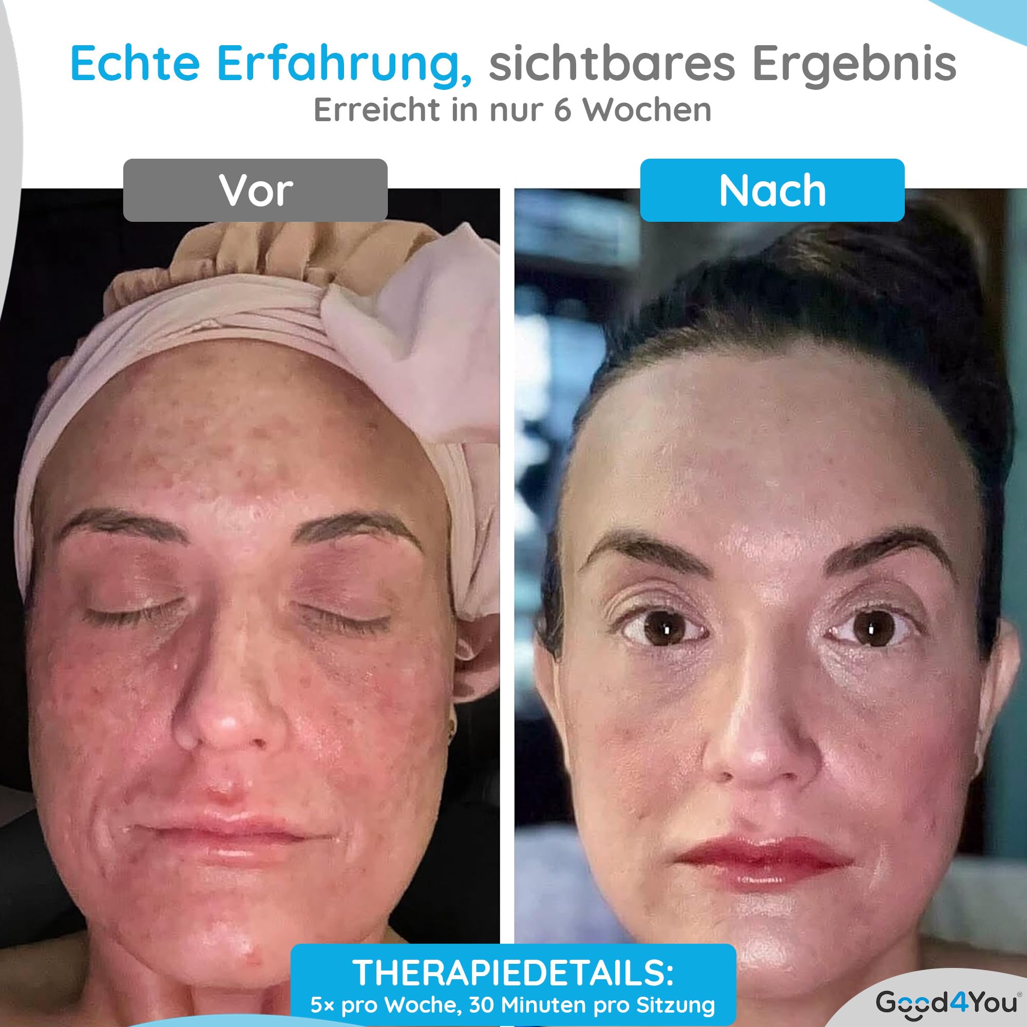 Good4You - LED-Gesichtsmaske - LED-Maske - LED-Maske Hautpflege - LED-Therapie - Gesichtsmaske - Akne-Behandlung - Infrarot-Therapie - Infrarotlampe - Lichttherapie- 7 Farben - Timer - Weiß