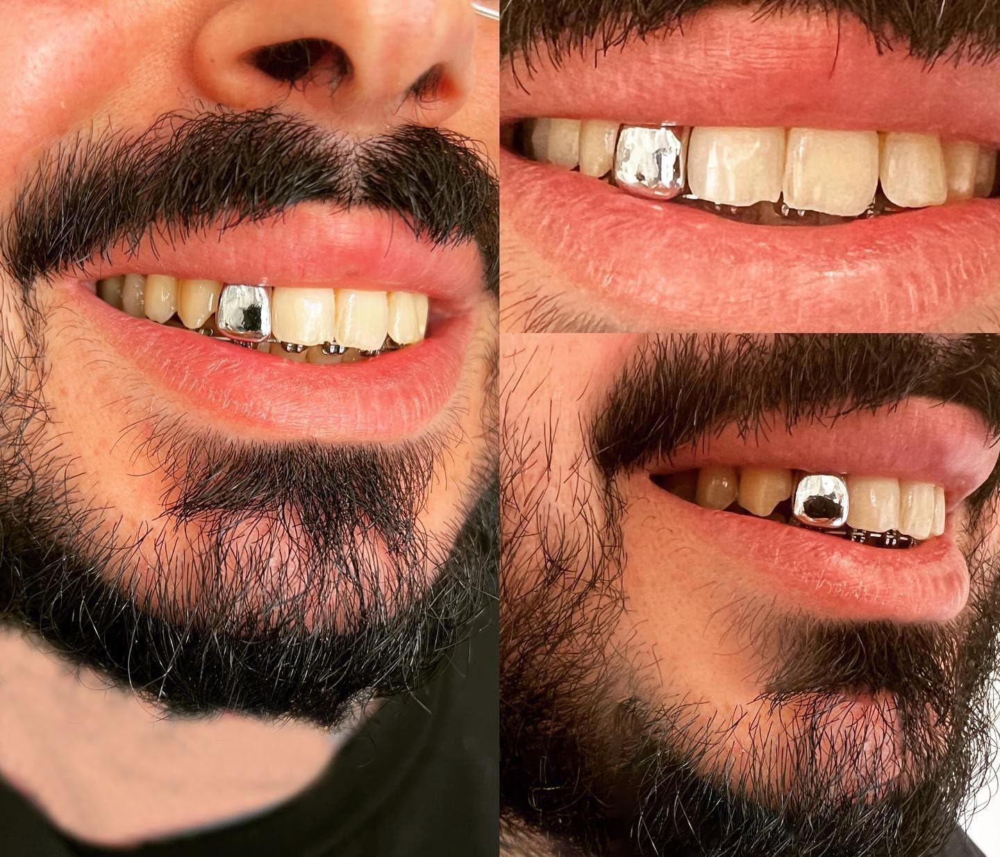 TOPGRILLZ Grillz Gold Tooth Cap Teeth Grills for Your Teeth 4pcs 18K Gold/Silver Plated Single Grillz for Women Hip Hop Rapper Jewelry Costume