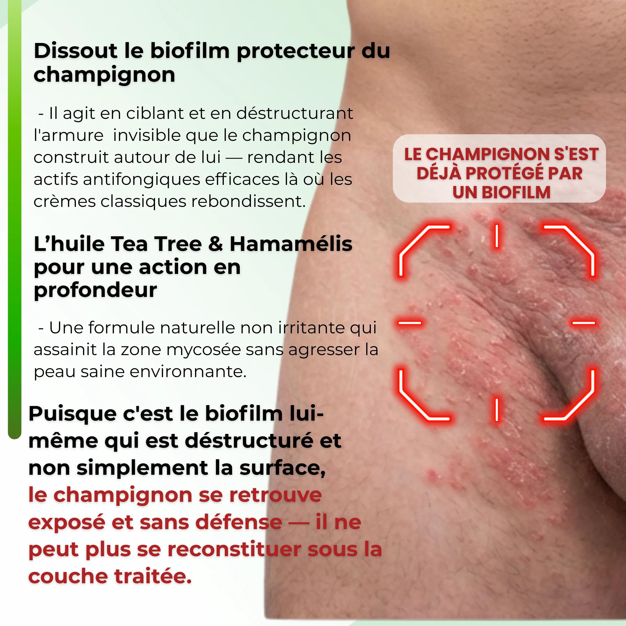 Savon antifongique Dermave Savon solide purifiant huile d'arbre à thé – visage et corps pour peaux à problèmes, nettoie en profondeur, régule le sébum, parfum frais
