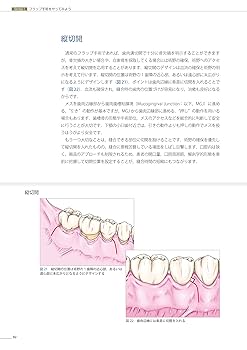【裁断済み】医歯薬出版 フラップ手術のすすめ フラップ手術のすすめ 基本手技+歯周組織再生療法・歯周形成外科