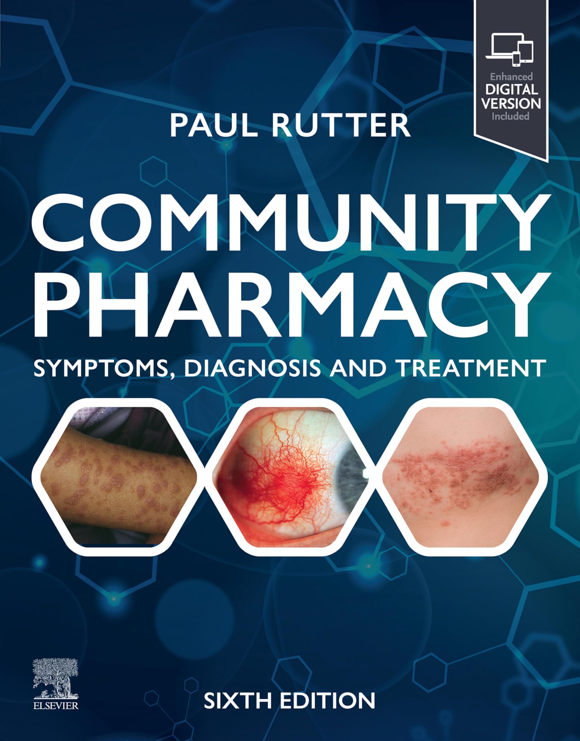 Community Pharmacy - E-BOOK: Symptoms, Diagnosis and Treatment (English Edition)