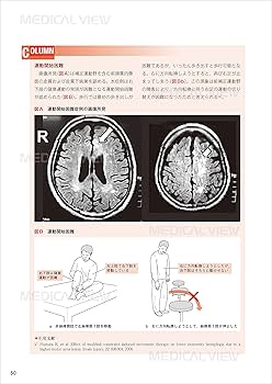 脳機能の基礎知識と神経症候ケーススタディ−脳血管障害を中心に