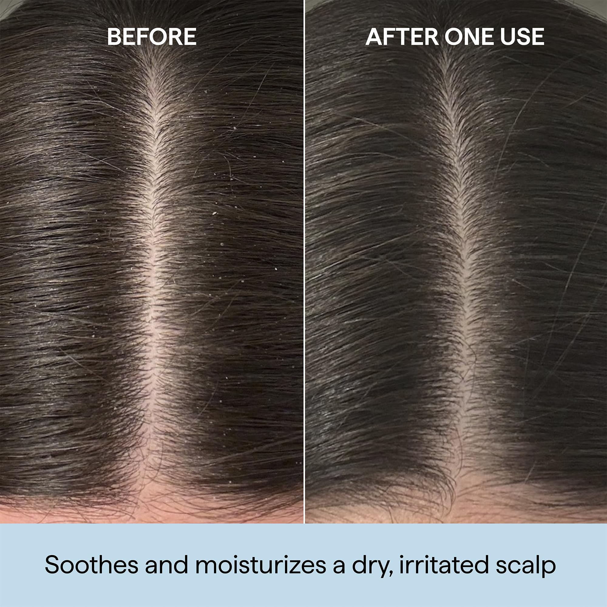 Briogeo Scalp Revival - Aceite de prelavado de romero para cabello y cuero cabelludo, tratamiento de cuero cabelludo seco, 100 ml
