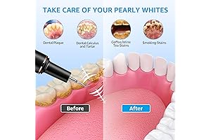 The Ultimate Plaque Terminator: Your Path to a Pearly White Smile!