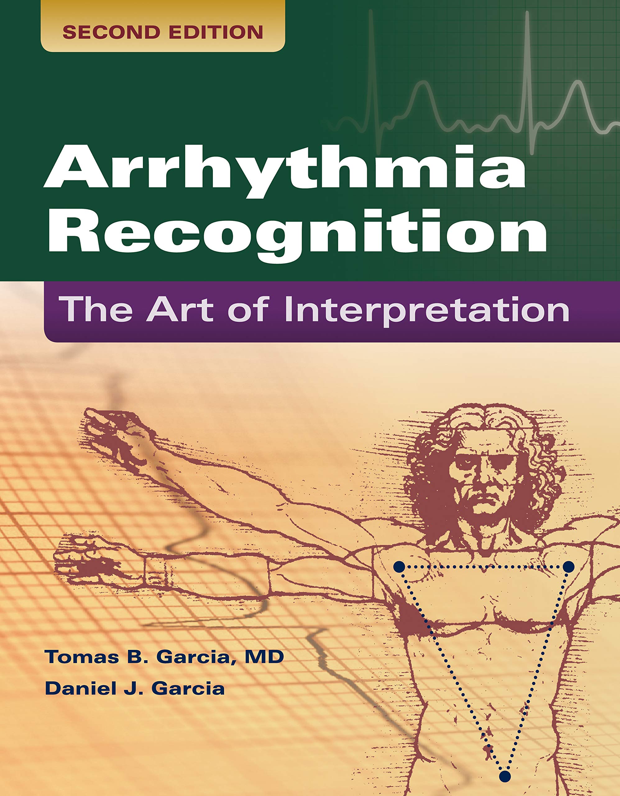 Arrhythmia Recognition: The Art of Interpretation