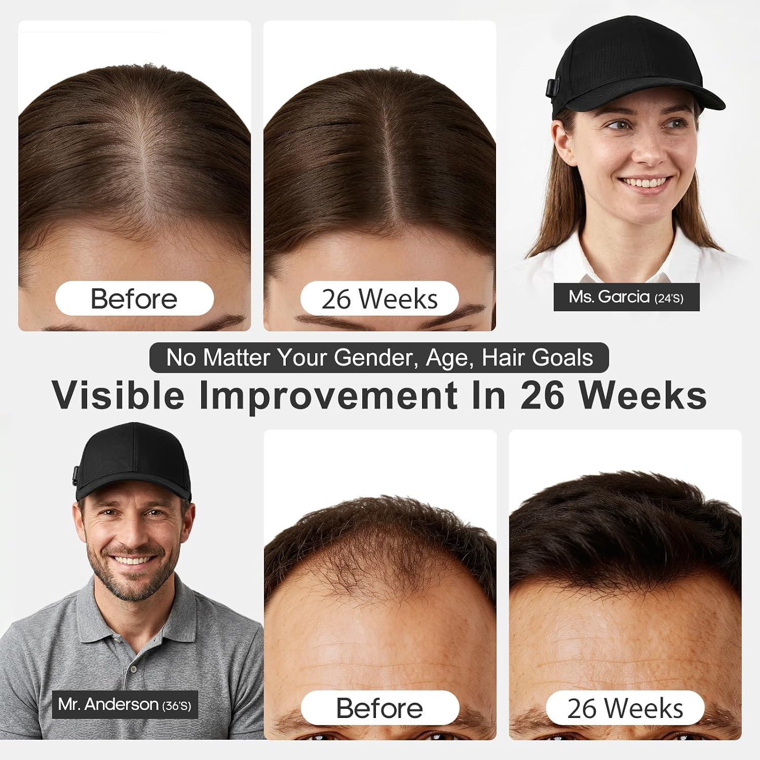 Red Light Cap for Hair Regrowth with 180 LED Beads and 5 Care Modes