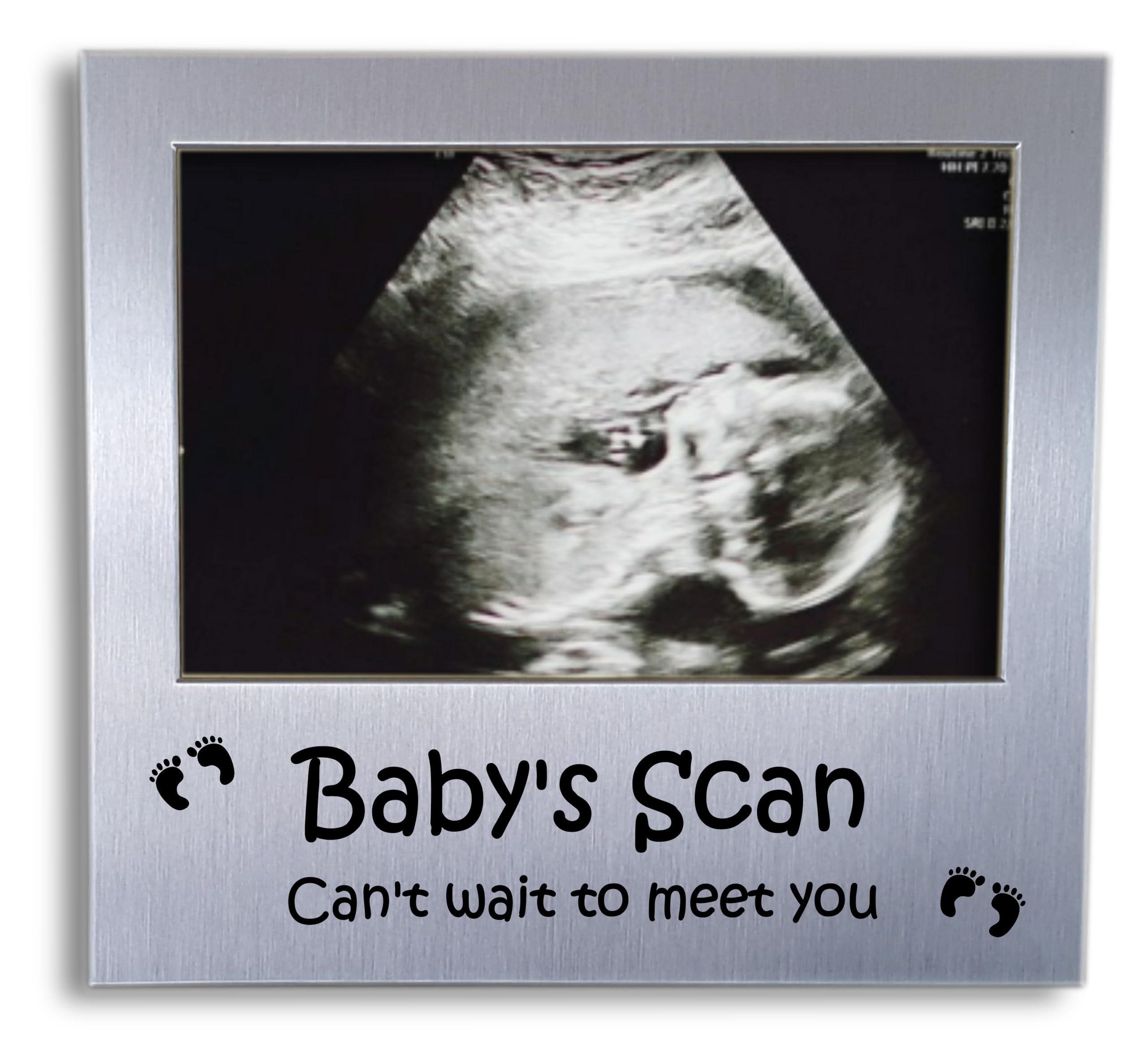 Baby's Scan Photo Frame - Ultrasound Picture Present - Baby Scan Gifts - Keepsake Image Pregnancy Gift - 5 x 3.5 inch
