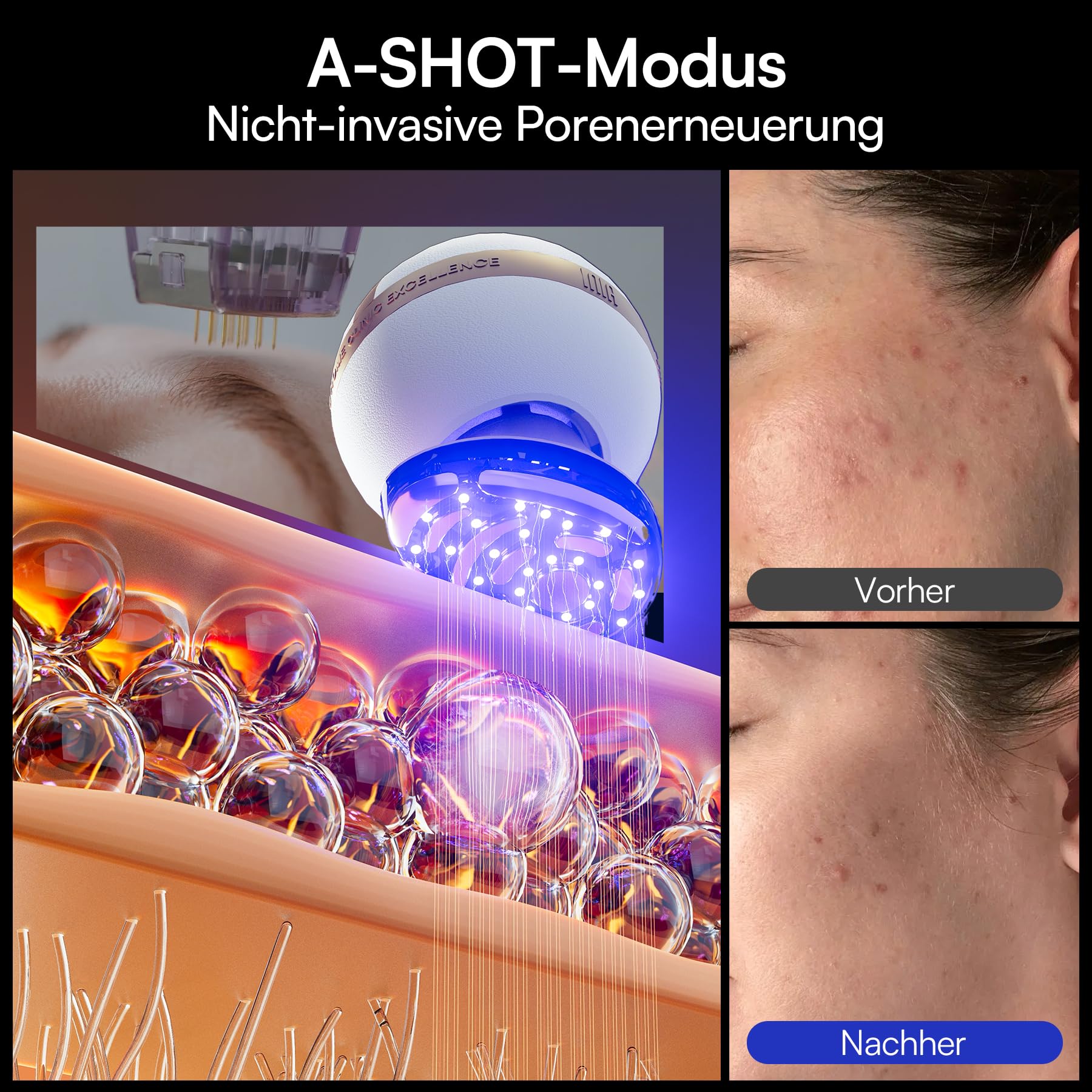 INIA SPHERA Verbesserter 8-in-1 Mikrostrom-Gesichtsmassager für Gesicht & Hals – Rotlicht, Wärme- & Kühlfunktion, 5 Modi, Beauty-Tool für definierte und strahlende Haut zu Hause