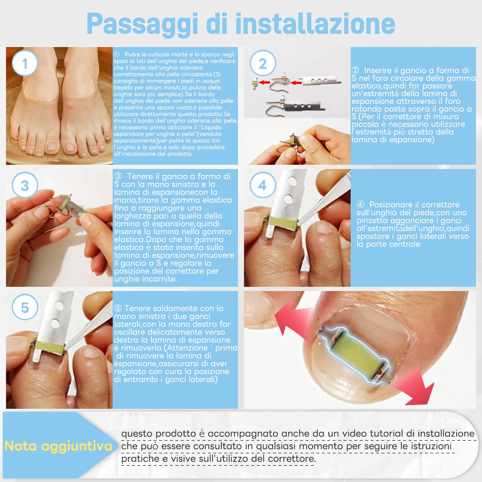InhwRior Correttore per unghie incarnite, facile da usare a casa, stabile e sicuro, senza scivolamento, trazione continua per un sollievo rapido dal dolore, impermeabile per la doccia (19mm-21mm)
