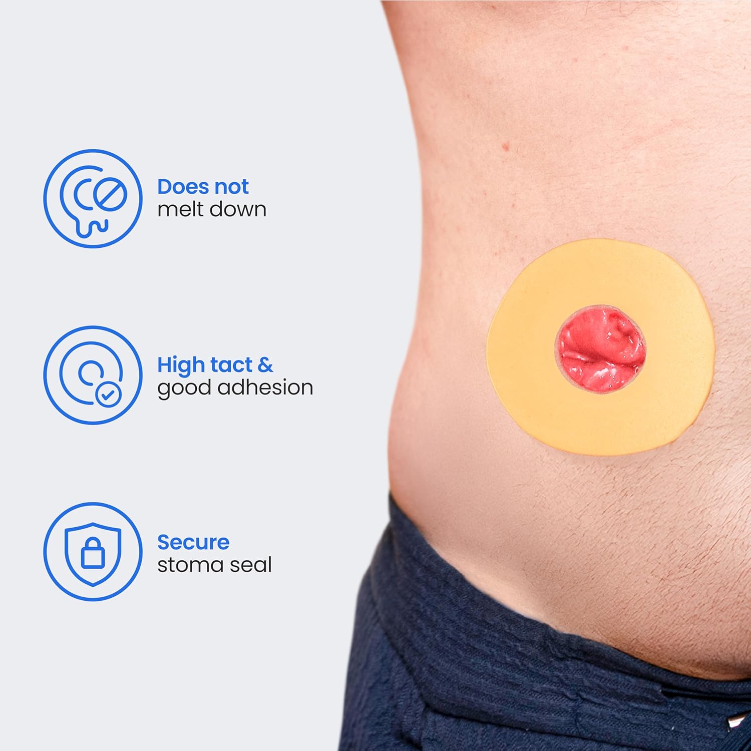 Safe n' Simple Conforming Adhesive Seals - 4 Inch - Pack of 10 - Stoma Barrier Rings Barrier - Cohesive Skin Barrier - Accessories for Ostomy-Colostomy-Ileostomy- Supplies