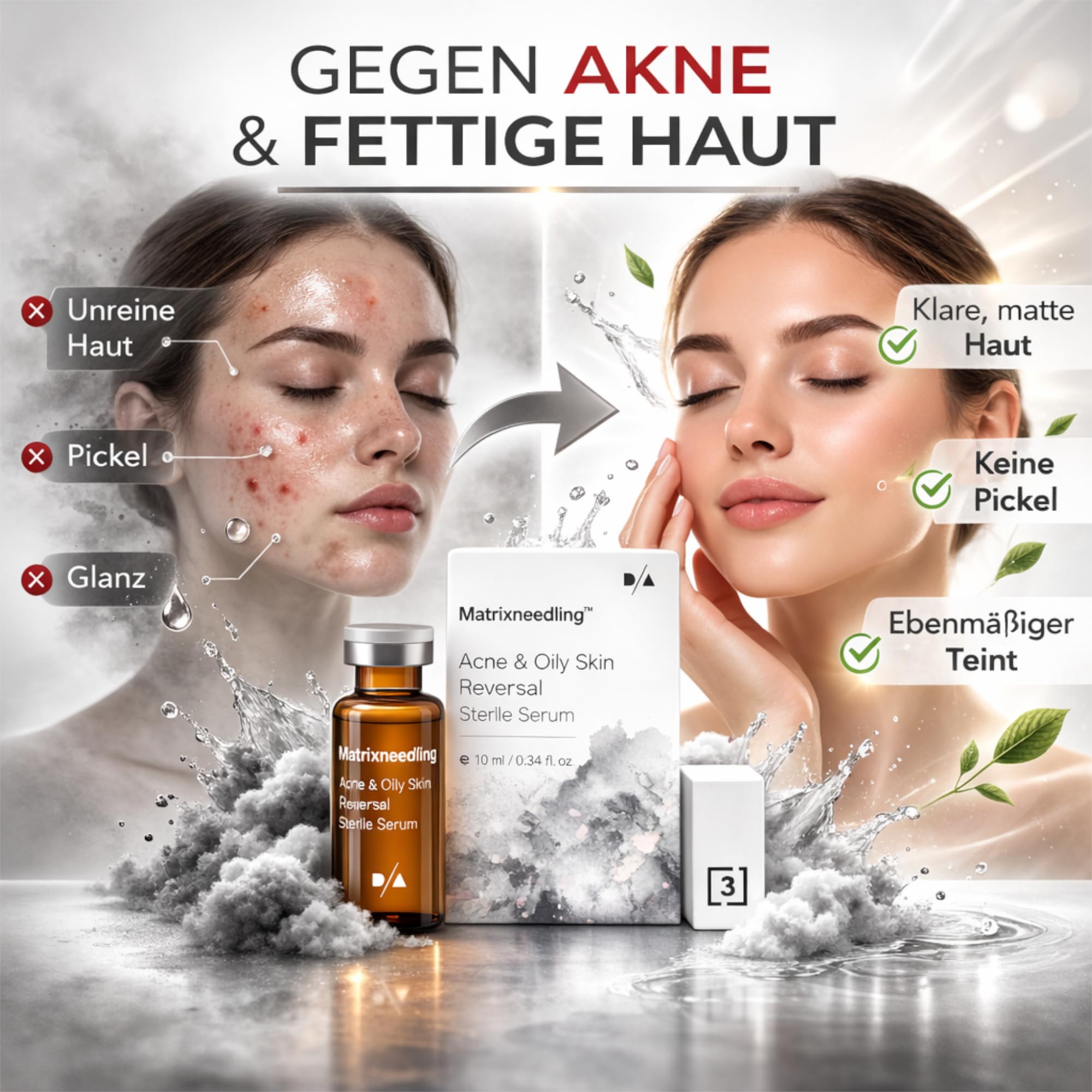 Matrixneedling™ Acne & Oily Skin Reversal – Microneedling Serum gegen Akne & fettige Haut – Niacinamid, Vitamin C & Peptide – Steriles Gesichtsserum für Dermapen & Dermaroller
