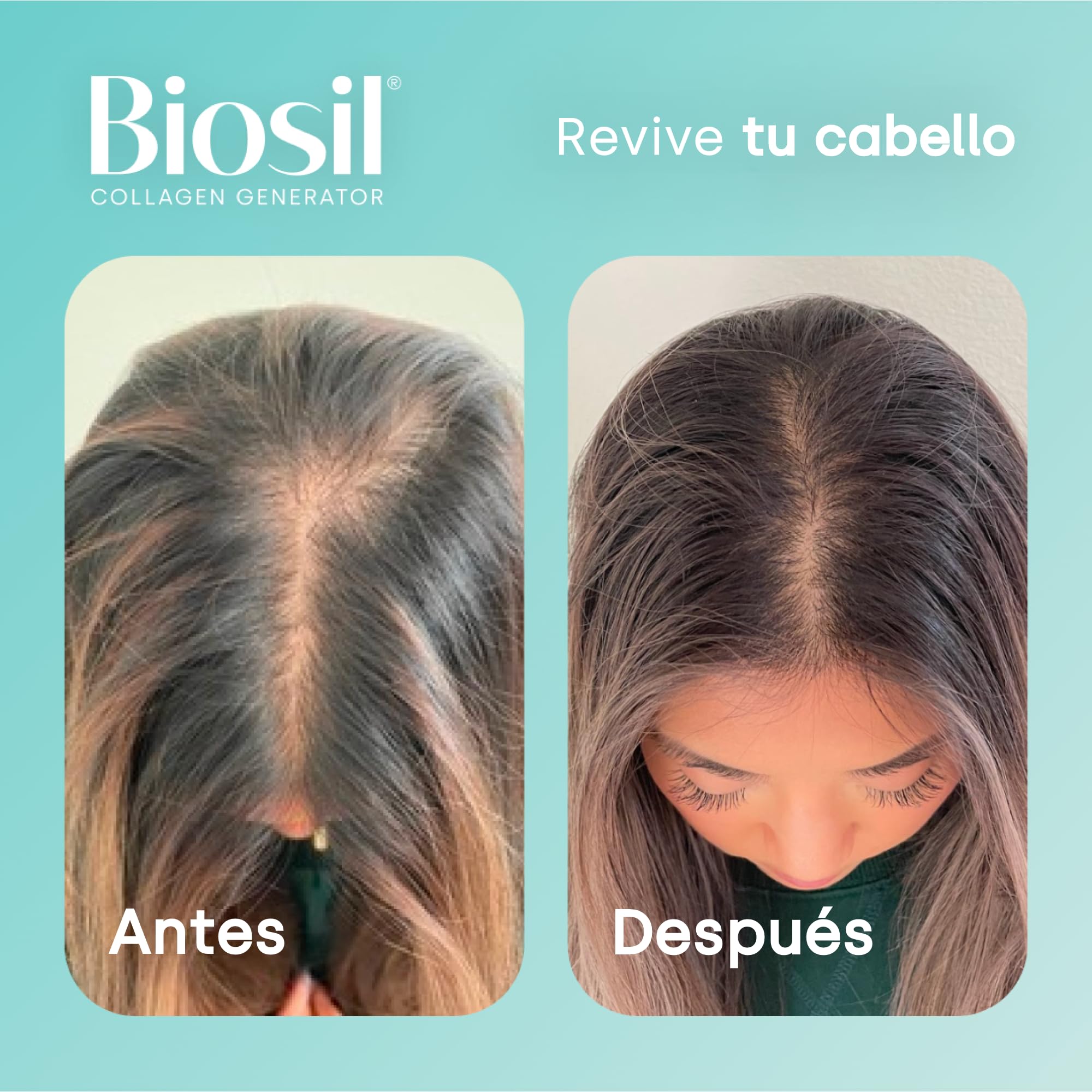 Biosil Collagen Generator - 120 cápsulas blandas - Con el complejo patentado ch-OSA - Genera y protege tu propio colágeno - Libre de OGM - Suministro para 60 días