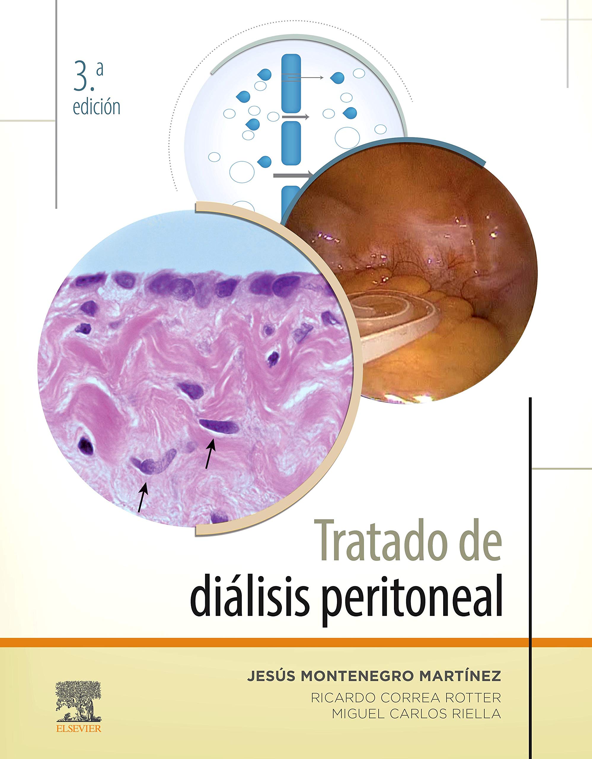 Tratado de diálisis peritoneal (3ª ed.)
