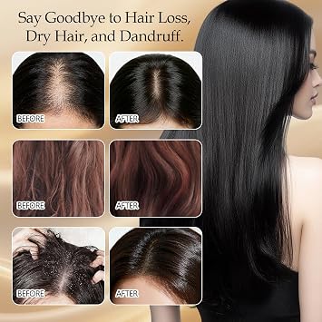Ginger Anti-Hair Loss Shampoo Y5B-C20-01 Nourishes the scalp reduces hair loss strengthens hair - 10 individual bags for on the go