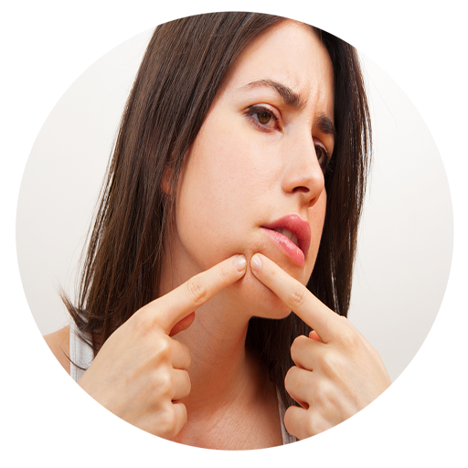 Tips to Remove Pimples on Face App on Amazon Appstore
