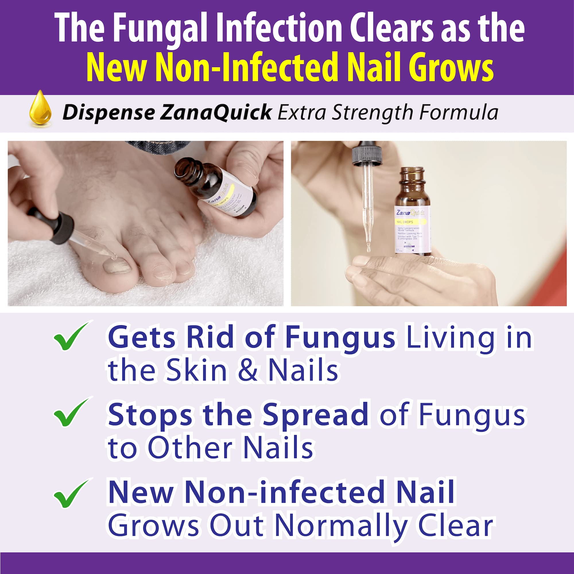Buy ZanaQuick Toenail Fungus Treatment Drops 2 Pack Nail Fungus