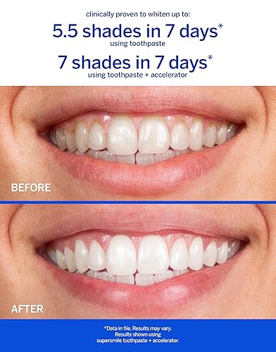 Miniatura 3 de Supersmile Professional Whitening Toothpaste  Fluoride Toothpaste for Visibly Whiter Teeth  Whitens up to 6 Shades