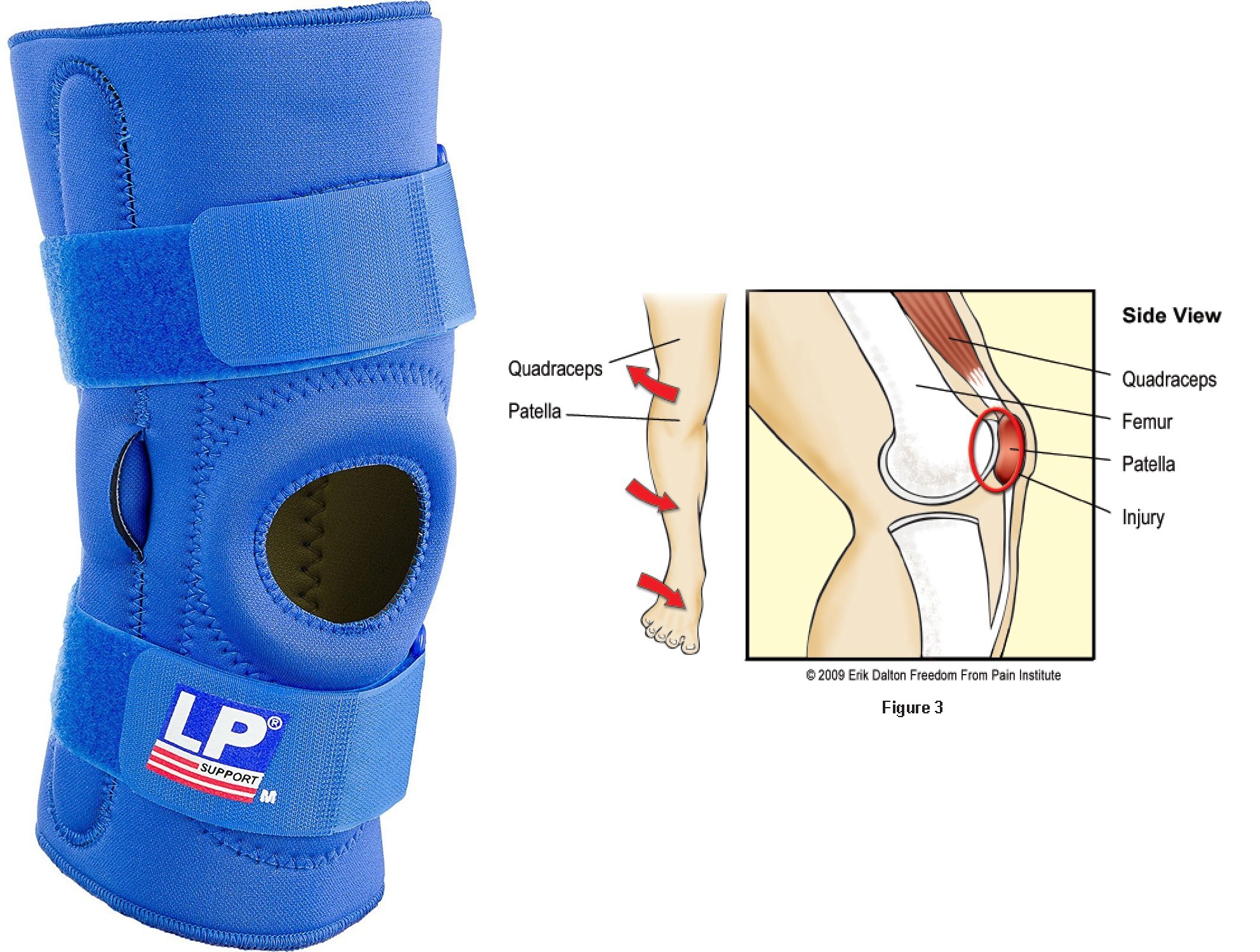Buy SDA Neoprene HINGED Patella STABILISING Knee Support Adjustable