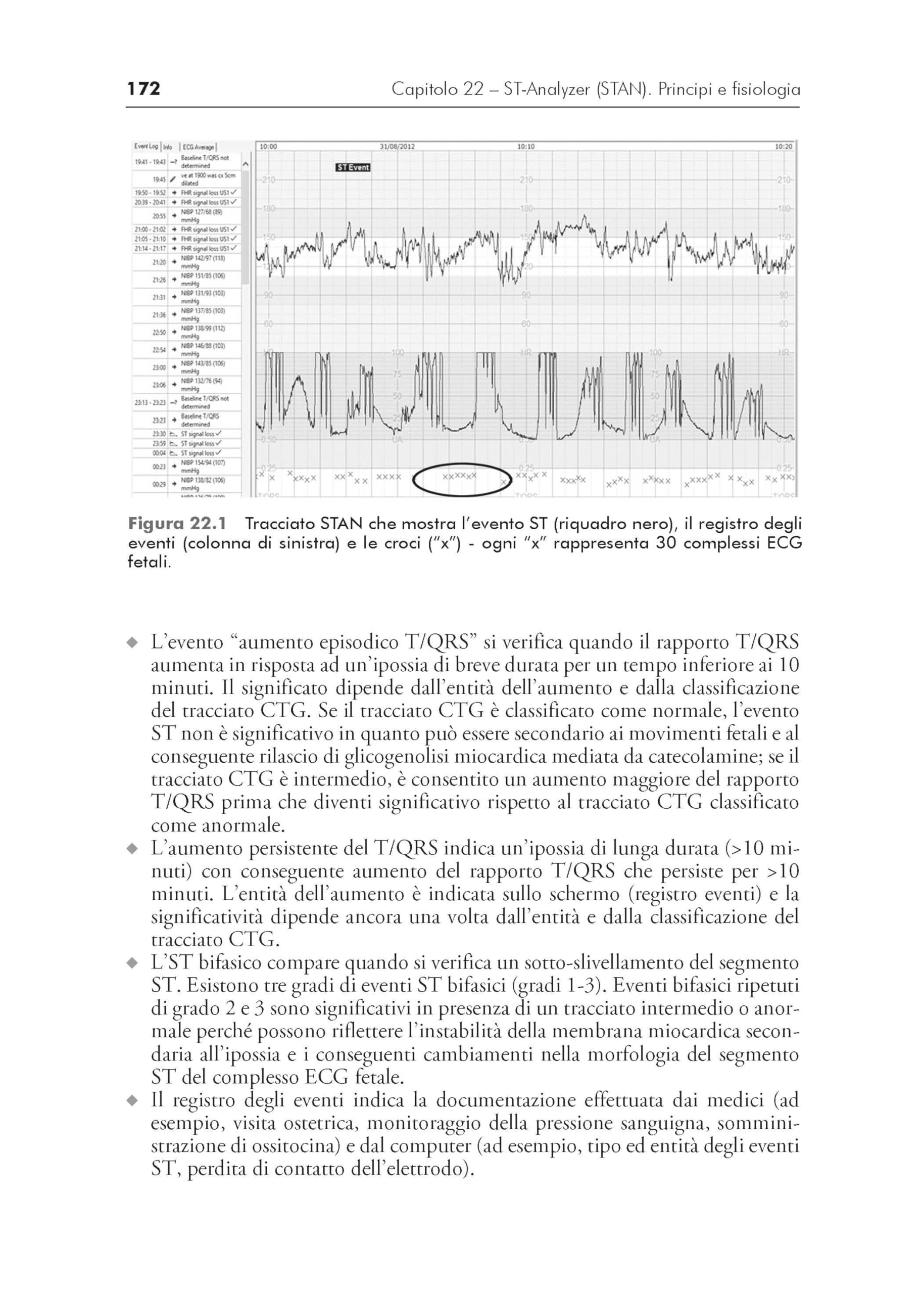 Manuale di interpretazione della cardiotocografia. Dai quadri ctg alla fisiologia