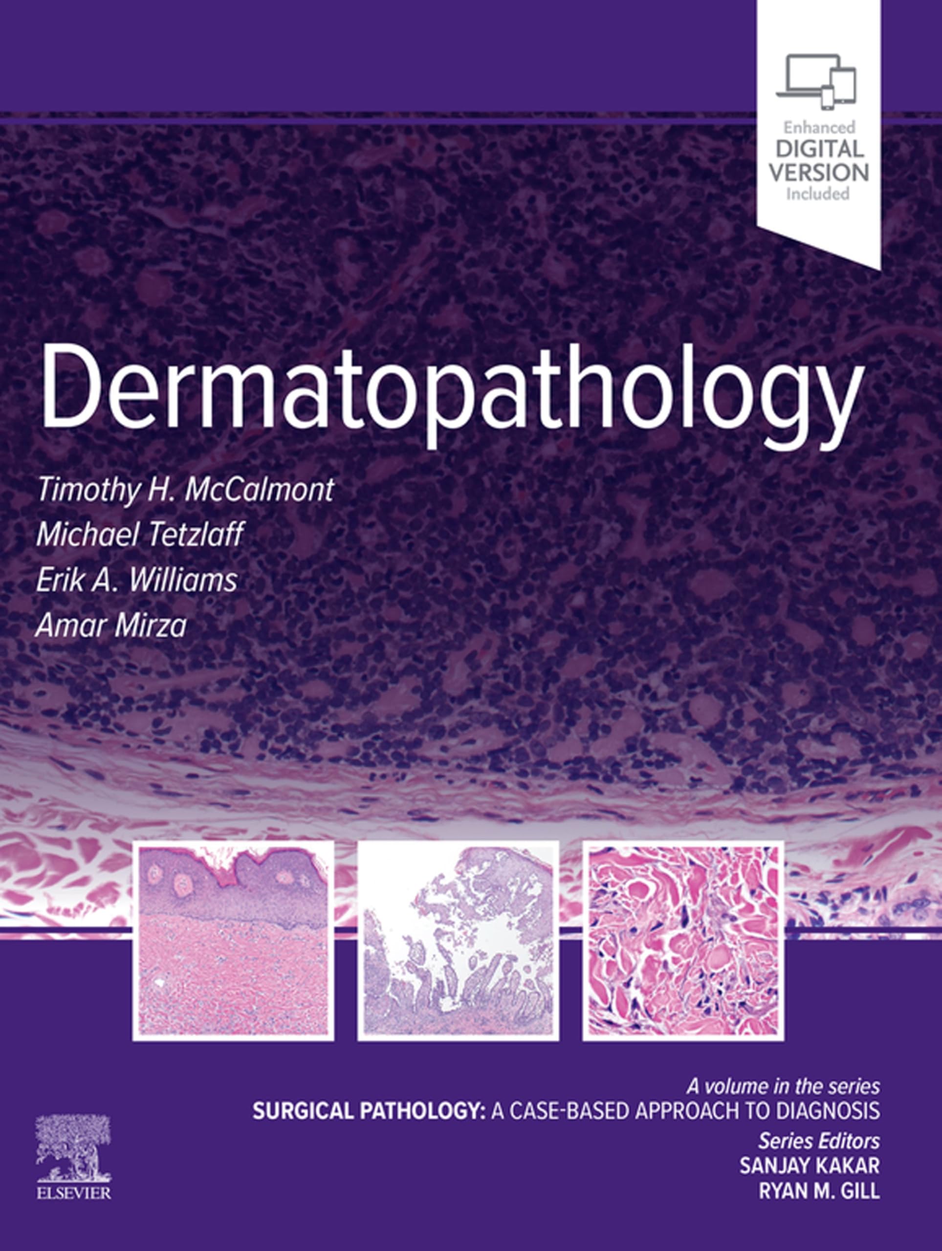 Dermatopathology - E-Book: Surgical Pathology: A Case-Based Approach to Diagnosis (Surgical Pathology: A Case Based Approach to Diagnosis) (English Edition)