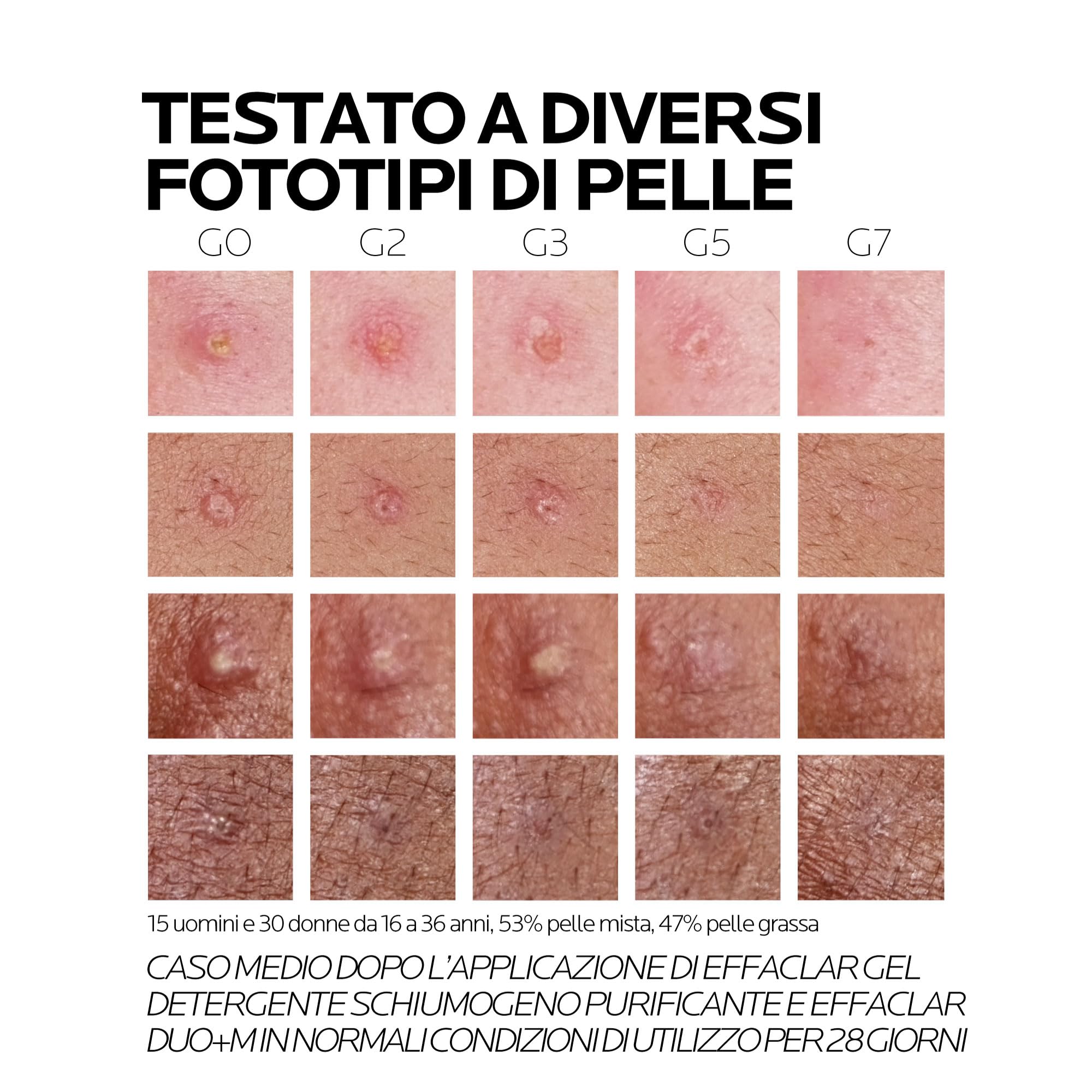 La Roche Posay Effaclar Duo + M, Trattamento Tripla Correzione Anti-Imperfezioni, Per Pelli Grasse a Tendenza Acneica, Effetto Anti-Ricomparsa, Con Phylobioma, Procerad e Niacinamide, 40 ml