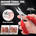 Toenail Clippers, Professional Thick & Ingrown Toe Nail Clippers for Men & Seniors, Pedicure Clippers Toenail Cutters, Super Sharp Curved Blade Grooming Tool (Red) gallery image