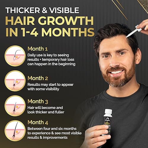 Miniatura 6 de Elevate Tratamiento de regeneración del cabello Solución de minoxidil al 5% para el crecimiento del cabello, suero tópico extra fuerte para el